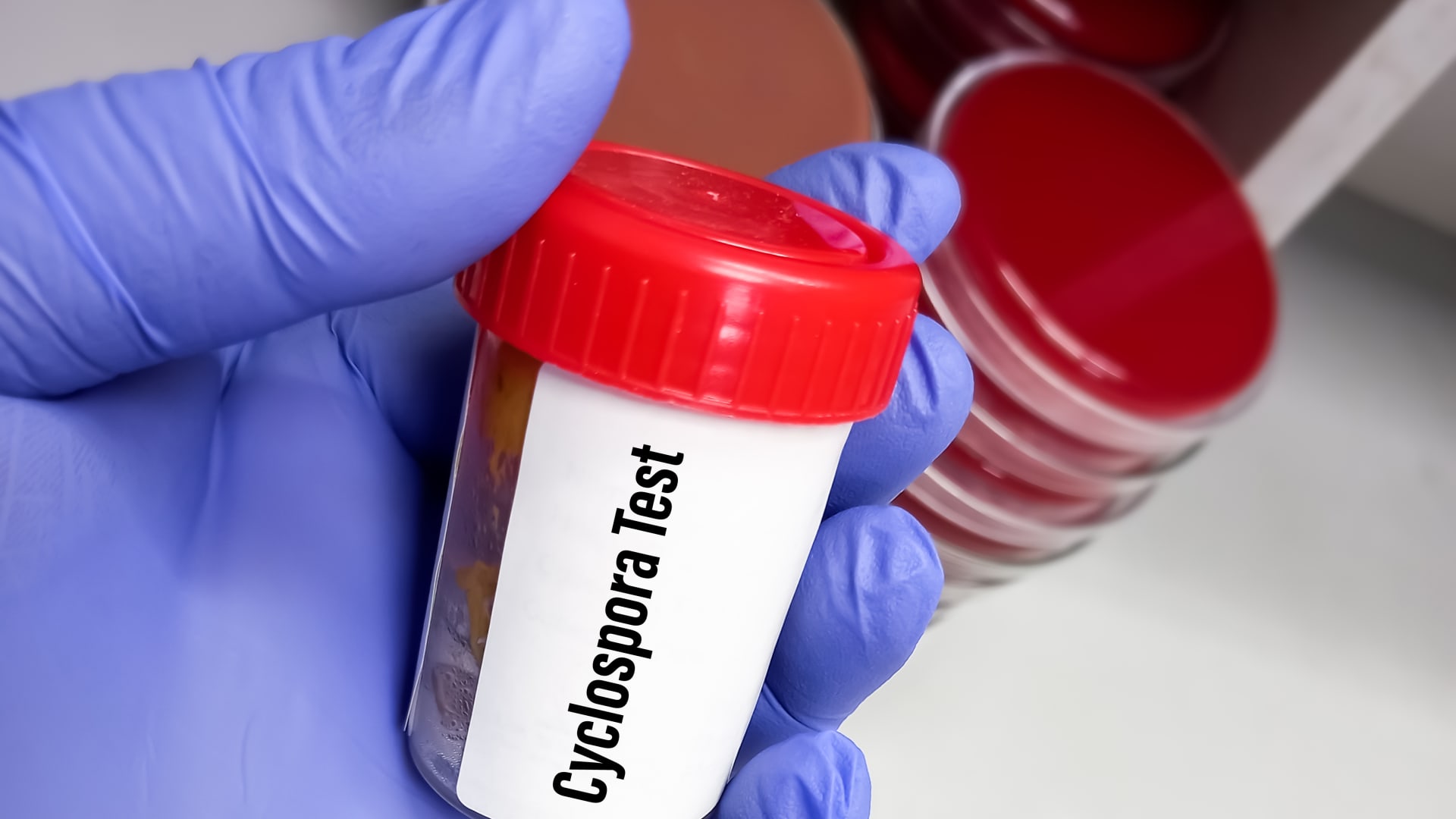 CDC acknowledges two Michigan deaths in Cyclospora outbreak